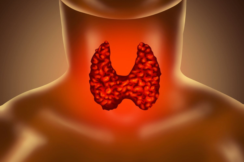 Hypothyroidism