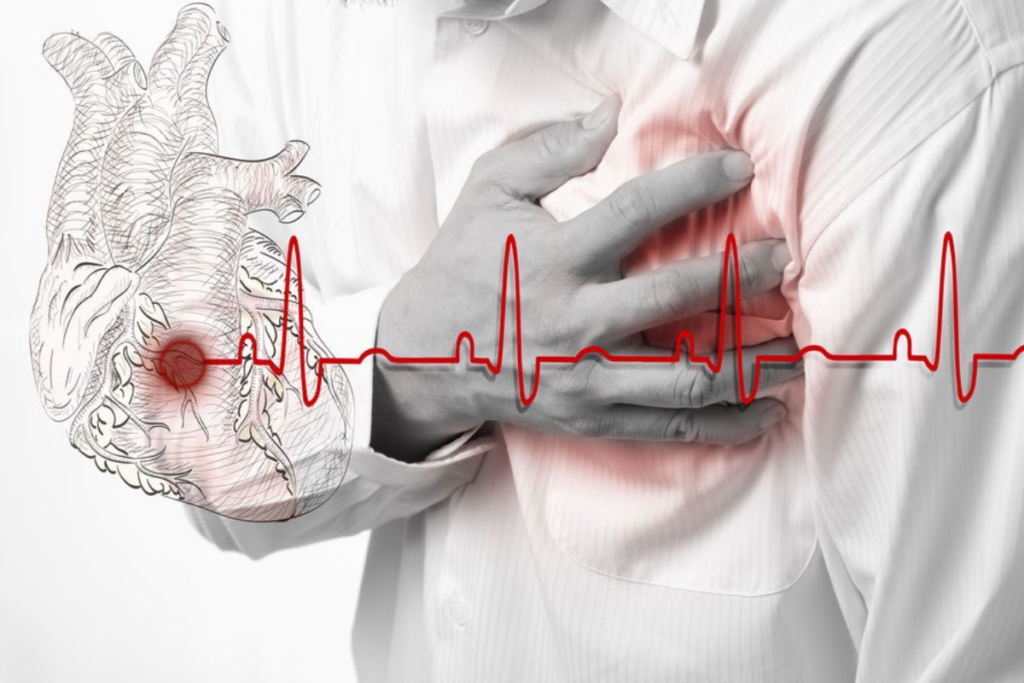 Heart Diseases and Stroke